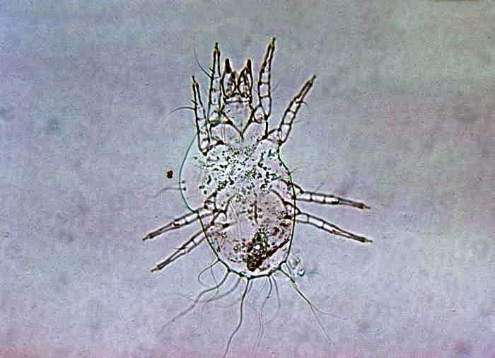 Mikroskopische Aufnahme einer Grasmilbenlarve Trombicula
